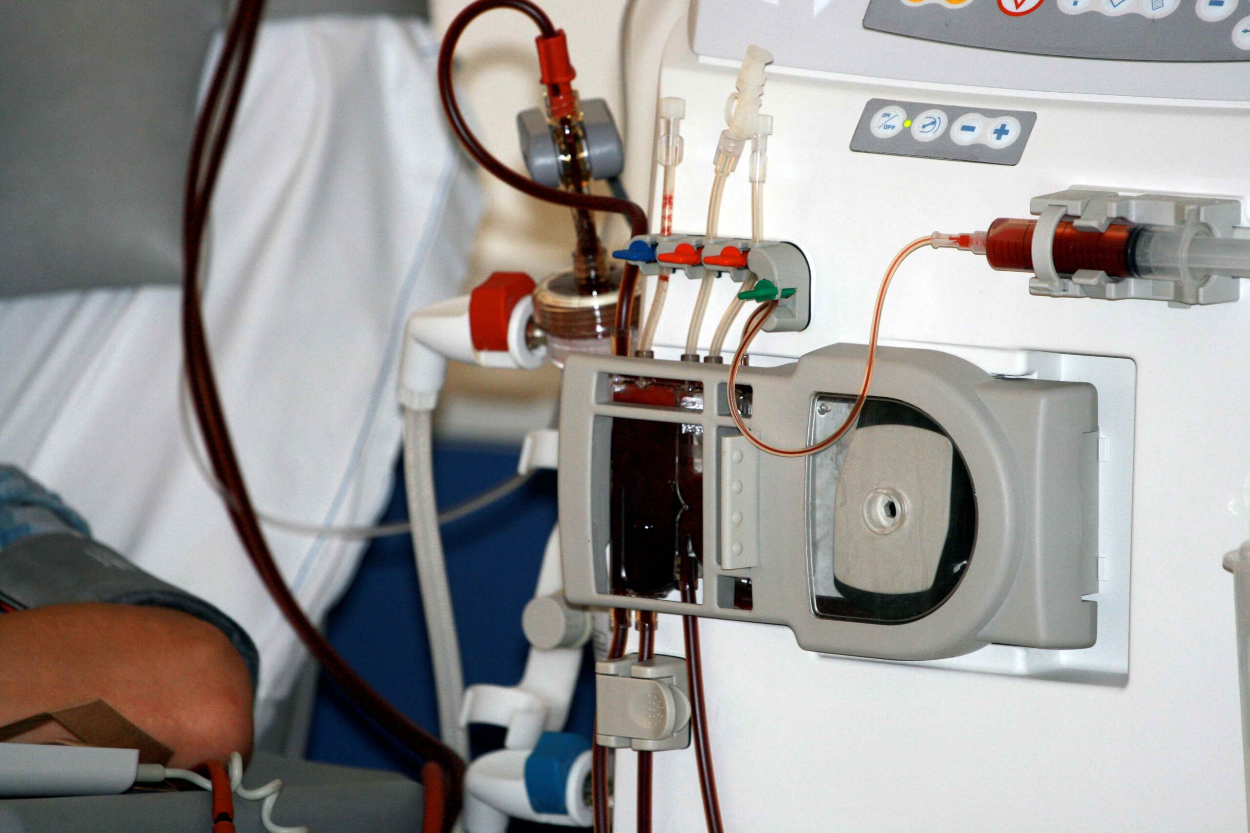 dialysis